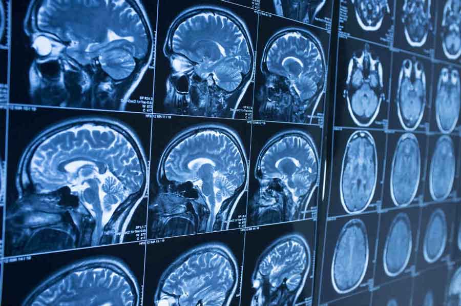 neuroimaging
